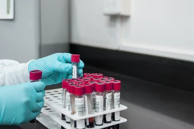 High neutrophil counts after fits (seizures) or vomiting
